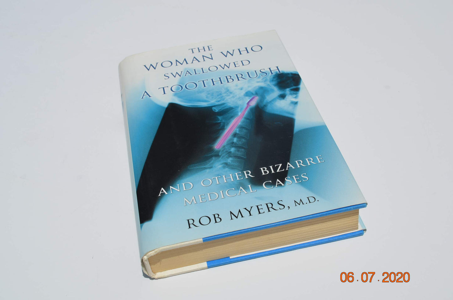 The Woman Who Swallowed a Toothbrush and Other Bizarre Medical Cases