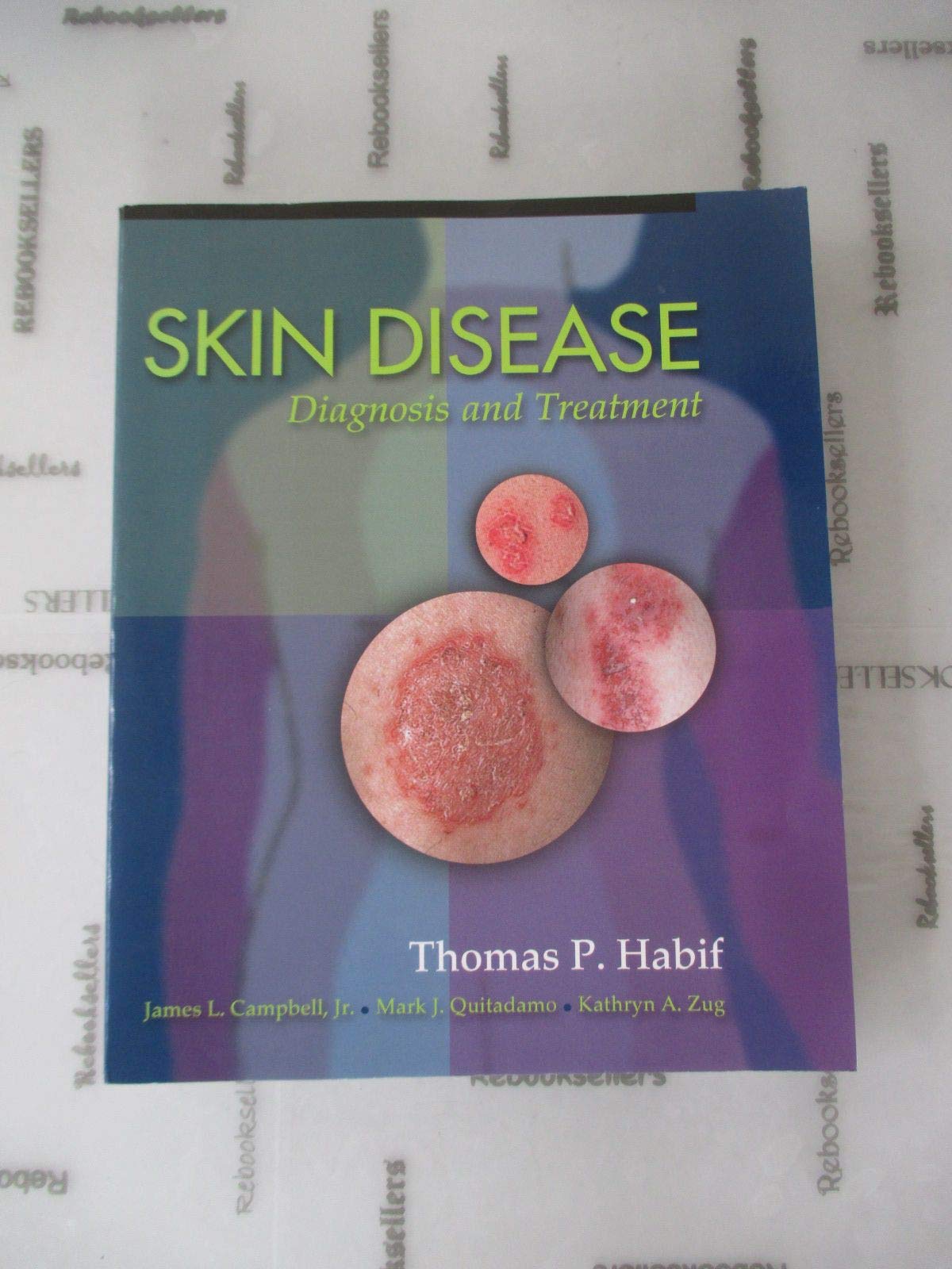 Skin Disease: Diagnosis And Treatment